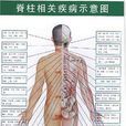 脊柱相关疾病示意图 脊柱相关疾病示意图