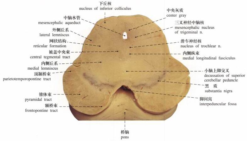 脑干症状群 脑干症状群