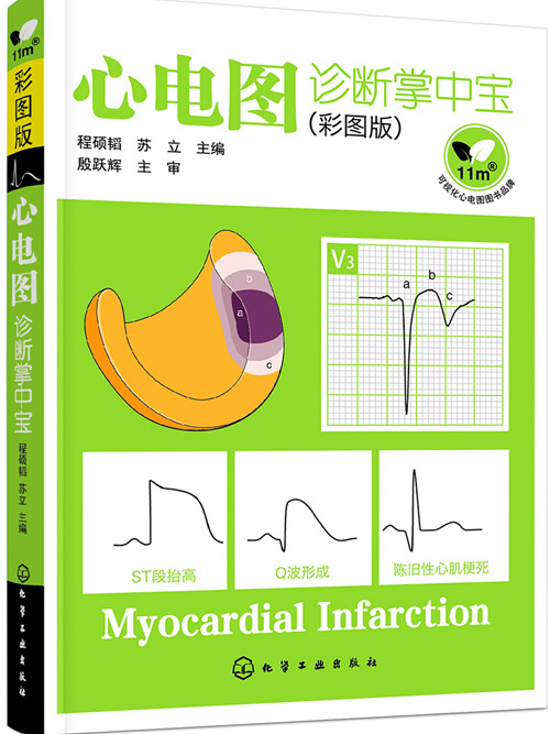 心电图诊断掌中宝(彩图版) 心电图诊断掌中宝(彩图版)