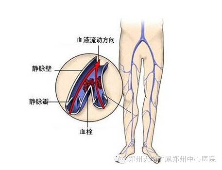 下肢静脉 下肢静脉