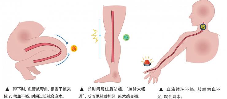 分筋错骨手(一种擒拿术)
