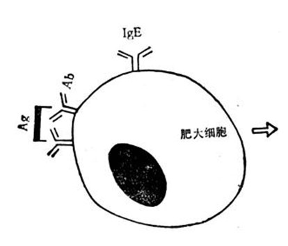 Ⅰ型变态反应示意图 Ⅰ型变态反应示意图
