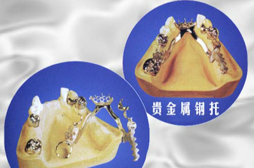 贵金属合金