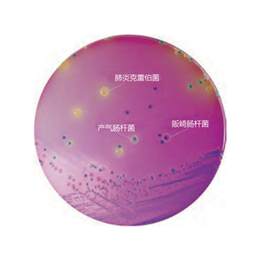 肺炎克雷伯氏菌 肺炎克雷伯氏菌