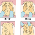 胎儿臀位(胎儿臂位)