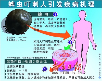 发病机理 发病机理