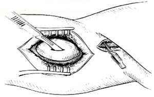 3 3