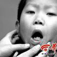 慢性铅中毒