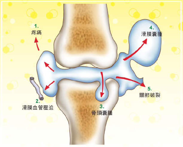 滑膜
