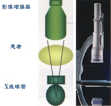 冠状动脉造影简介 冠状动脉造影简介