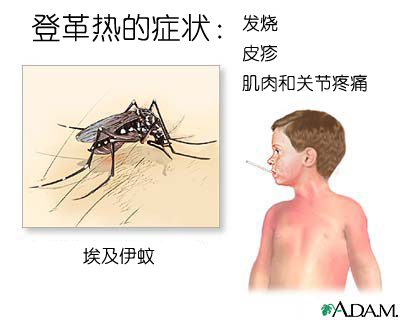 登革热的症状 登革热的症状