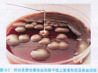 肺炎克雷伯氏菌 肺炎克雷伯氏菌