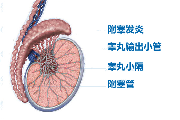 阴囊坠胀痛