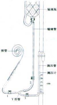 中心静脉压测定&amp 中心静脉压测定&amp