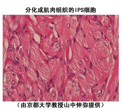心肌细胞 心肌细胞