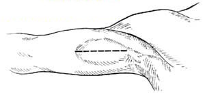 1 1