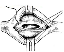 6 6
