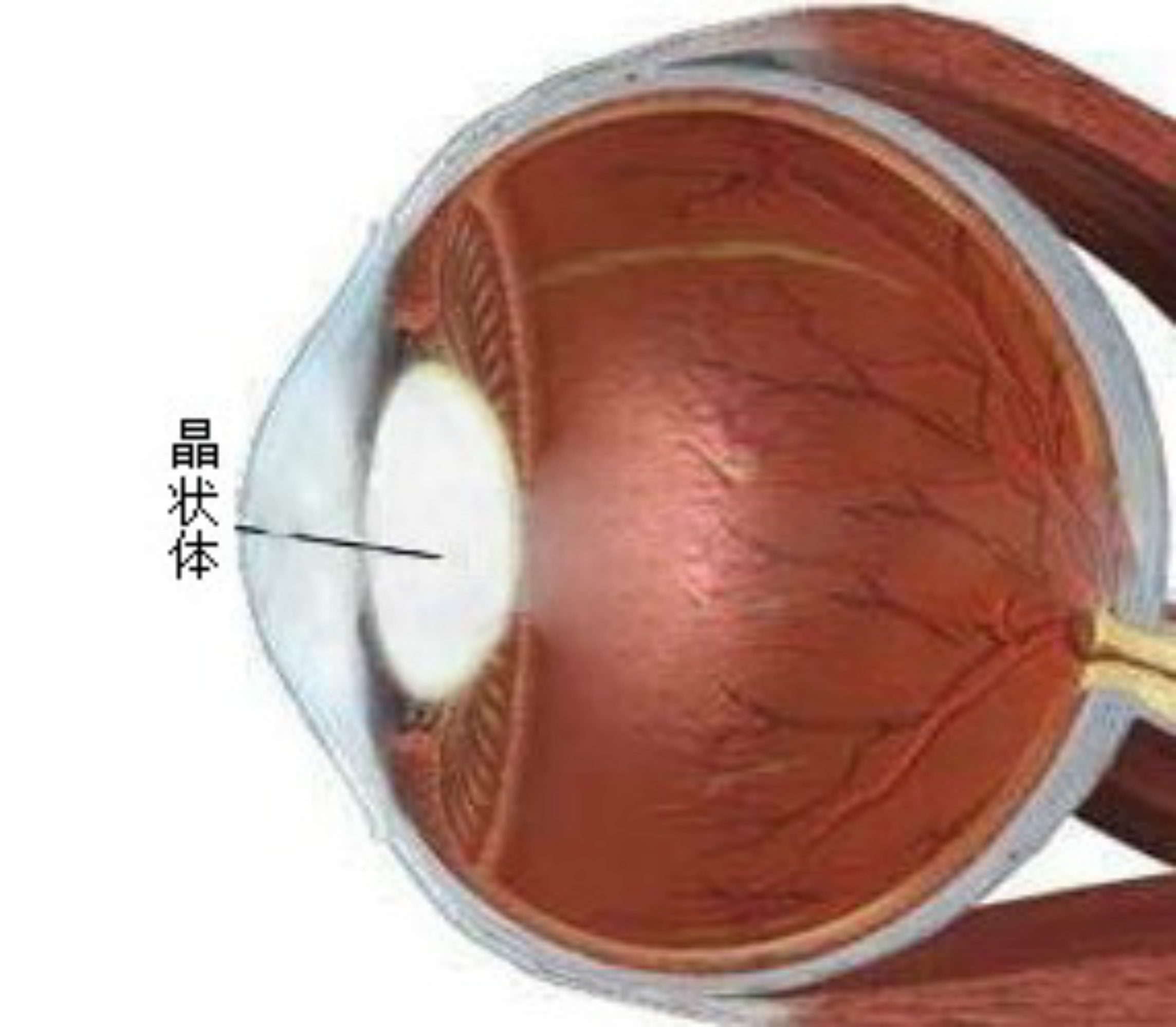 晶状体囊