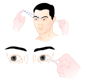 角膜反射图解 角膜反射图解