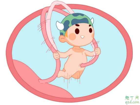 脐带绕颈顺产有危险吗 胎儿脐带绕颈要注意什么2