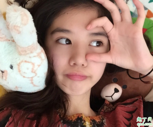 眼压高马上会得青光眼吗 青光眼隔几代遗传1