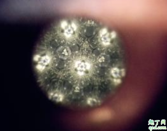白内障手术后飞蚊症怎么办 飞蚊症和玻璃体混浊是一种病吗3