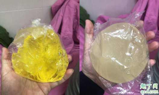 假体隆胸能不能哺乳 隆过胸了还能喂奶么4