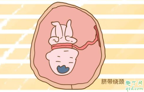 新生儿脐带有点出血怎么回事 脐带脱落几天了还出血怎么办3