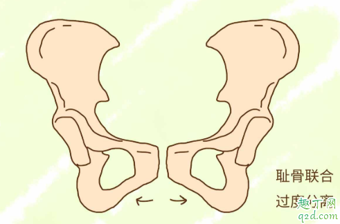 孕中期耻骨疼的走不了路怎么办 孕期耻骨疼起来真要命1