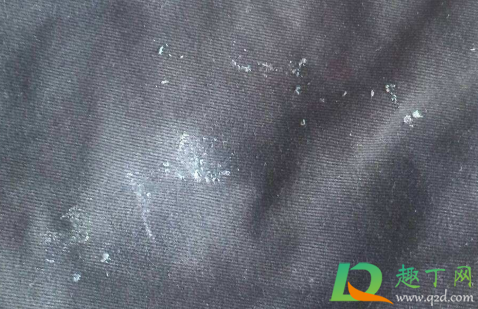 衣服上的口香糖用什么东西能洗掉3