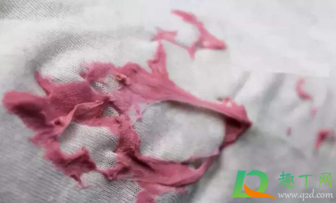 衣服上的口香糖用什么东西能洗掉2