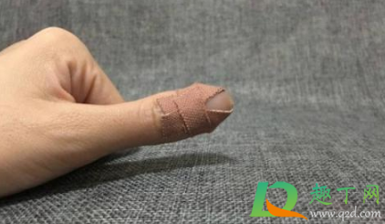 指头割了一个口子怎么处理1