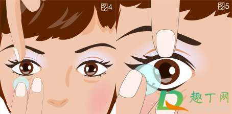 戴隐形眼镜睡觉眼睛模糊看不清是怎么回事4
