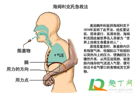 最基本的急救有哪几种2